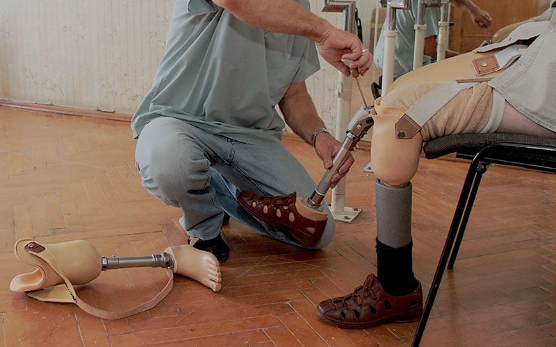 Artificial Limbs to Makea Real Difference