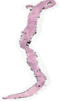 Fig 1: Example whole-slide image (WSI) of a pathology slide (hematoxylin & eosin stain)