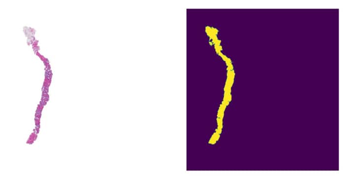 Fig 4: WSI Slide and Corresponding Refined Mask