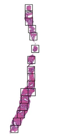 Fig 5: Applying the Intelligently selected coordinates on original slide covering only tissue content