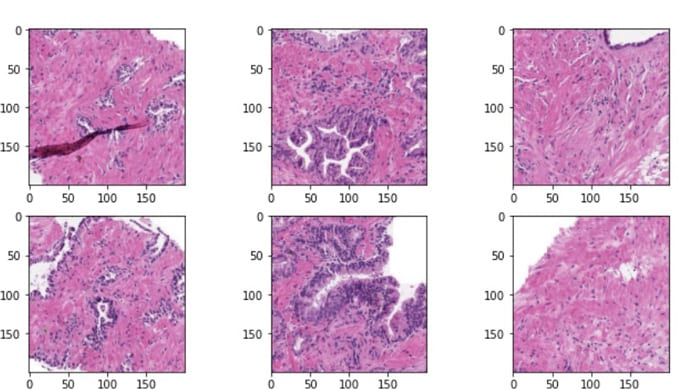Fig 6: Extracted Patches from Original Slide
